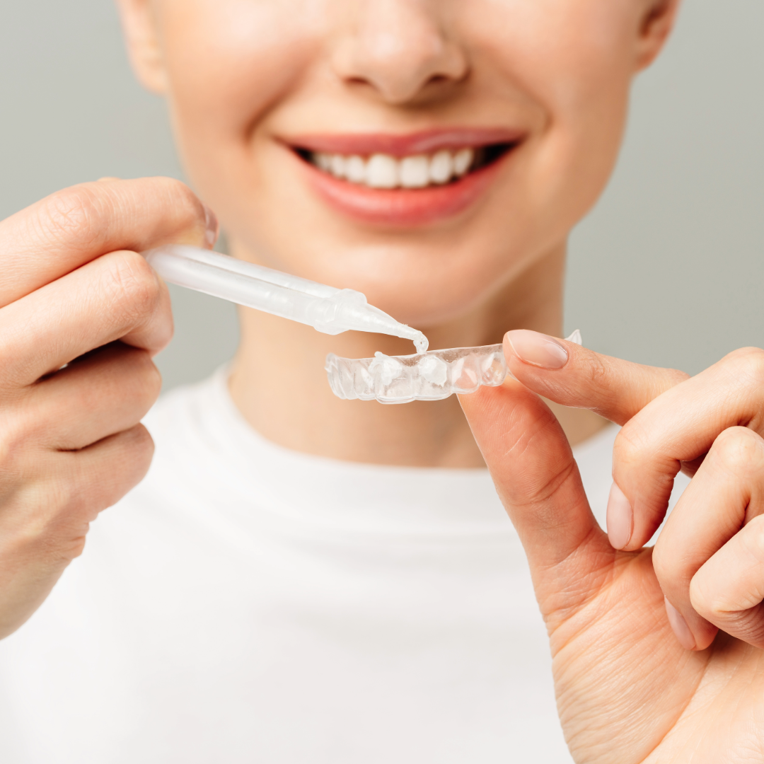 Types of Teeth Whitening