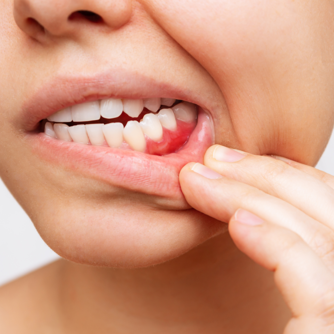 5 Signs You May Need to See a Dental Hygienist
